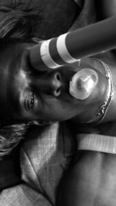 A dancer wearing a wig lies on their back with a baseball bat over one eye and a condom in their mouth.