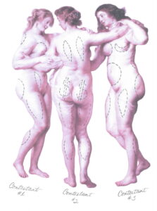 Three nude women embrace in a circle. There are lines on their body showing where a cosmetic enhancement might happen.